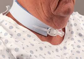 Image result for Tracheostomy