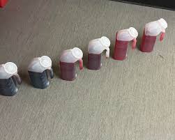 Image result for Continuous Bladder Irrigation