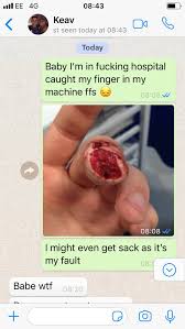 Check spelling or type a new query. Man Pulls Ultimate April Fool S On Girlfriend With Severed Finger Prank Ladbible