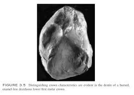 Find the best wellesley, ma carpet rug upholstery storage repair on superpages. April 2013 Holocaust History Channel