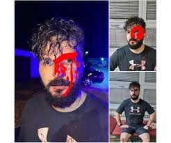 Odbijen zahtev za postavljanje „ležećih“ policajca ispred zgrade  napravljene između rijeke Drine i magistralnog puta