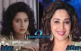 He believes in not only giving patients the best possible medical care but also in achieving a sensitive understanding of their aesthetic goals. Madhuri Dixit Plastic Surgery Before And After Photos Plastic Surgery Celebrity Plastic Surgery Plastic Surgery Facts