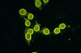 Image result for ANA Staining Pattern