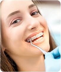 We did not find results for: Cost Of Braces How Much Braces Really Cost Fusion Orthodontics