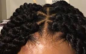 A dutch braid is very similar to french braid the only difference is crossing. Effects Of Tight Braids What To Do When Your Braids Are Too Tight