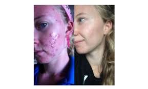 TOOLKIT community end — HOL:FIT