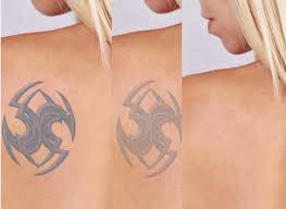You can also filter out items that offer free shipping, fast delivery or free return to narrow down your search for tattoo removal cream! Bltr Cream Painfree Tattoo Removal For Colour Black
