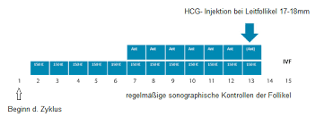 Der blastozystentransfer ist ein embryotransfer, bei dem ein oder mehrere embryonen in einem sehr fortgeschrittenen entwicklungsstadium, dem sogenannten blastozystenstadium, in die gebärmutter übertragen werden. Https Online Medunigraz At Mug Online Wbabs Getdocument Pthesisnr 46664 Pautornr Porgnr 1