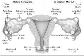Uterine Tube Pregnancy An Overview Sciencedirect Topics