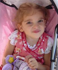 El trastorno se caracteriza por varios defectos sobre la salud, como la enfermedad de hirschsprung, retraso mental, epilepsia. Isabella Mowat Wilson Syndrome Foundation