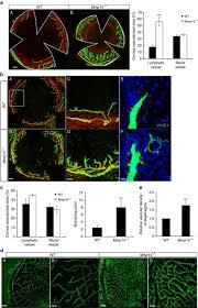Check spelling or type a new query. Mt1 Mmp Sheds Lyve 1 On Lymphatic Endothelial Cells And Suppresses Vegf C Production To Inhibit Lymphangiogenesis Nature Communications