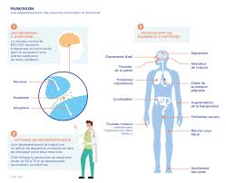 Summary parkinson disease is a complex, heterogeneous neurodegenerative disorder. De Nouvelles Approches Pour Mieux Lutter Contre La Maladie De Parkinson Leem
