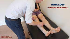 Seeking medical advice early will. Diabetic Foot Examination Osce Guide Geeky Medics