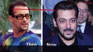 The career of the celebrity could have ended due to this. Pin On Satya Hair Transplantation