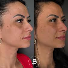 Dra. Fernanda Domingues (@drafernandadomingues) • Instagram photos and  videos