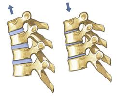 11 фраз в 5 тематиках. Funktion Der Bandscheiben