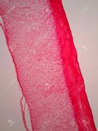 Tendons are remarkably strong, having one of the highest tensile strengths found among soft tissues. Cross Section Human Tendon Under Microscope View Stock Photo Picture And Royalty Free Image Image 74959524