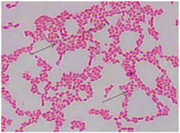 During in the 1980s, se emerged as an important cause of human illness in the united. Macroscopic Observation Of S Enteritidis In Xld And Rsa Media A S Download Scientific Diagram