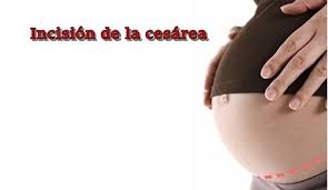 Recuperacion De La Cesarea Y Ligadura De Trompas Todopapas