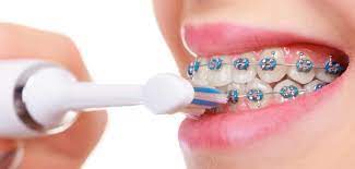 How to brush teeth with braces? How To Brush Teeth With Braces Using Philips Sonicare Electric Toothbrush Video