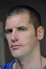 Gallery: Knife attack victim Matthew Garbutt (WARNING: graphic images)