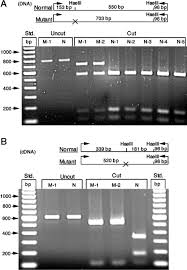 A Pro504 → Ser Substitution in the β-Subunit of β-Hexosaminidase A Inhibits  α-Subunit Hydrolysis of GM2Ganglioside, Resulting in Chronic Sandhoff  Disease