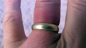 A Trick I Ve Used For Years Is Soap Or Another Lubricant To Slip The Ring Off But It Can Still Be Very Painful To Wedding Ring Finger Neat Tricks How To