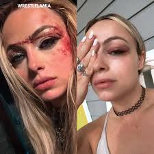 Liv Morgan gives an update