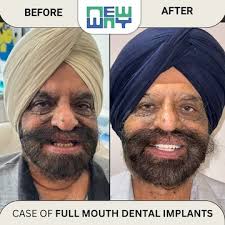 Dr. Gagan Deep Singh Anand (thirty Two Dental Clinic) in Mohali Sas  Nagar,Mohali