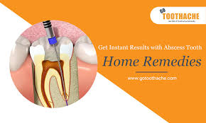 natural home remes for abscess tooth