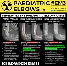 Pin By Dolly Barter On X Ray Fun Radiology Imaging Radiology Student Radiography