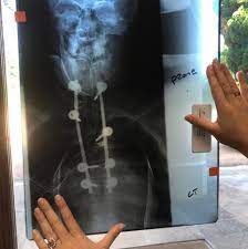 Check spelling or type a new query. Caras Eugenie Fala Da Cirurgia A Coluna A Que Foi Submetida Aos 12 Anos