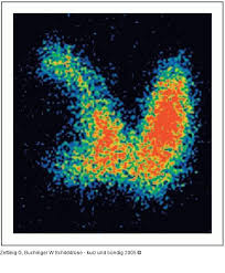 Mithilfe des anreicherungsverhaltens von intravenös verabreichten schwach radioaktiven substanzen kann man den funktionszustand der schilddrüse beurteilen. Abbildung 7 Schilddruse Szintigraphie