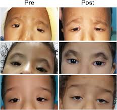 Image result for Blepharis transvaalensis