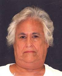 Dr. Robert Thein Porcelain Crown and Porcelain Veneers Case