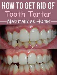 How To Get Rid Of Tooth Tartar Naturally At Home Inspiring Beauty Tips Teeth Health Gum Health Tartar Teeth