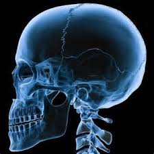 X Ray Of Human Skull Human Skull Skull X Ray