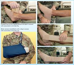 Image result for Envenomation