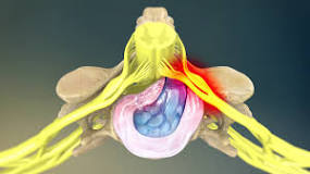 Image result