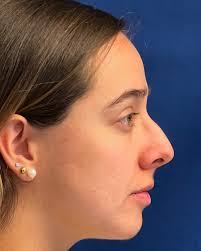 Instagram photo by Dr. Mario Botero Ramirez • May 3, 2024 at 7:37 PM