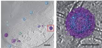 The image seen with this type of microscope is two viruses are so small they can only be seen under an electron microscope (em) as quite undefined. Seeing Viruses By Both Light And Electron Microscopy