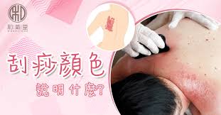 Guasa therapy is an ancient chinese massage that uses a scrapping board to scrap the body. åˆ®ç—§é¡è‰²å¦‚ä½•åæ˜ å¥åº·ç‹€æ³ åˆ®ç—§å‡ºç¾ç´«é»'è‰²æˆ–æ˜¯å±éšªè­¦è™Ÿ