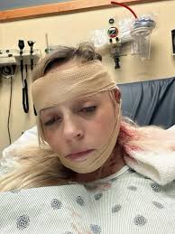 song lyrics about past accident and injury