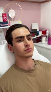 Masculinización Facial y Rinomodelación: Costo y Procedimiento