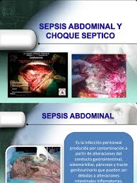 Check spelling or type a new query. Presentacion Sespsis Abdominal Y Choque Septico Septicemia Inflamacion