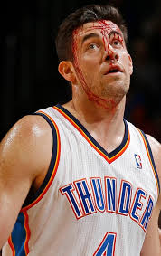 Nick Collison after taking an elbow to the head 2014 :  r/AccidentalRenaissance