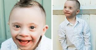 Lidé s downovým syndromem mají typický mongoloidní vzhled. Downuv Syndrom Nebyl Prekazkou Chlapec Se Stal Modelingovou Hvezdou Svet Kreativity