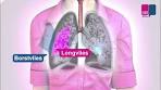 Video Pleuritis - wat gebeurt er in je longen? - YouTube