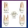 When the number of cusps is four, the three cusps are larger (mesiobuccal, mesiopalatal, and distobuccal cusps) and the smallest cusp is the distopalatal cusp. 1