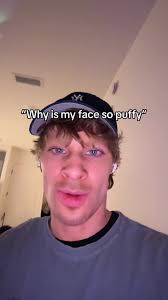 Coconut Water Method: Reduce Water Retention Naturally